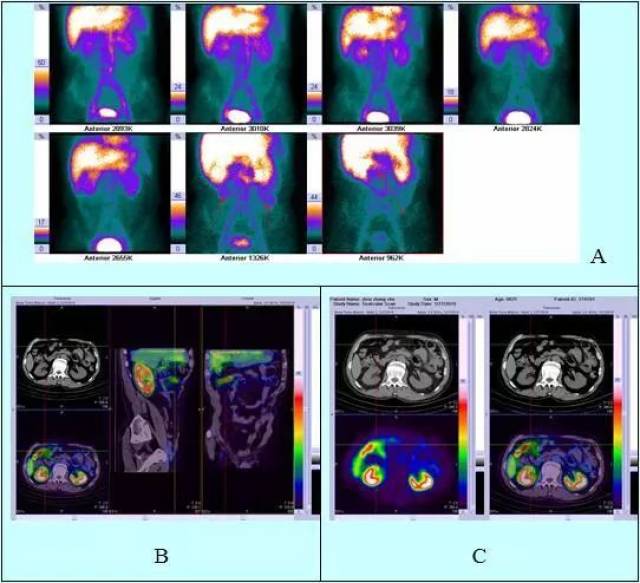 僵尸新战士 相关产品