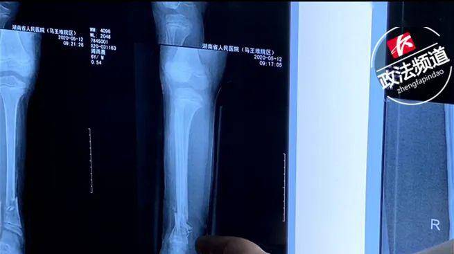 伟大的缺席 相关产品